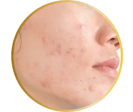 dvine australia