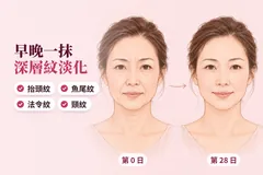 插畫：同一位四十幾歲嘅香港女士，第 0 日有抬頭紋、魚尾紋、法令紋同頸紋，第 28 日紋路淡咗；字句：早晚一抹，深層紋淡化